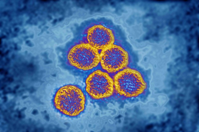 Flavivirus (family Flaviviridae), these viruses are responsible for yellow fever, dengue fever, Japanese encephalitis, Zika virus, West Nile encephalitis. They are transmitted by mosquitoes or ticks. image produced from transmission electron microscopy (viral diameter approximately 40 to 60 nm). (Photo by: CAVALLINI JAMES/BSIP/Universal Images Group via Getty Images)