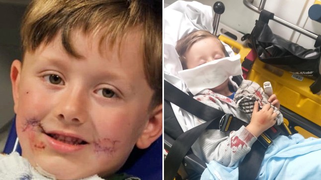 Pocket bully attack four-year-old Lancashire