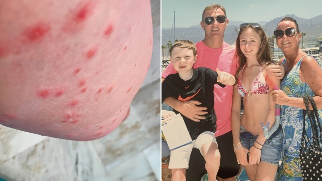 Mum in coma after mosquito bites cause her to fall down stairs on holiday post thumbnail image