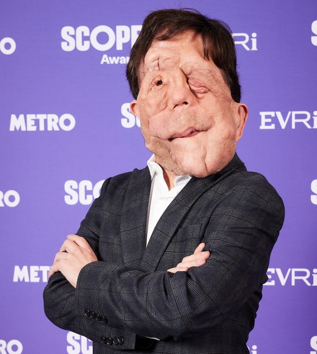 Actor Adam Pearson at the 2025 Scope Awards (Picture: Richie Hopson)
