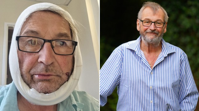 Gardener who sliced throat with a chainsaw says cops thought his wife did it post thumbnail image