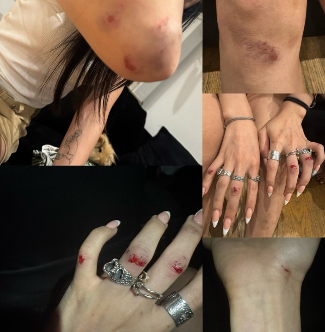 Transphobic attack on actor and model Jaylin Ye