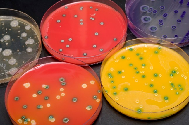 Bacterial plates, top view.